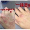 Yi Mo Ling Cream 图片 2