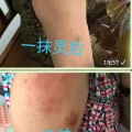 Yi Mo Ling Cream 图片 4