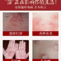 一抹灵/祛“湿”好货（现货）不含激素 图片 2