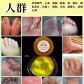 土方皮癣膏牛皮癣药膏土方脚气药膏湿疹寻麻疹皮炎过敏毛囊炎止痒脚气脱皮糜烂脚臭酸臭 图片 9