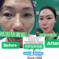 中药专业祛斑祛痘修护去痘印痘坑 图片 45