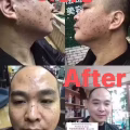 中药专业祛斑祛痘修护去痘印痘坑 图片 19