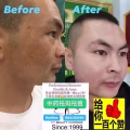 中药专业祛斑祛痘修护去痘印痘坑 图片 33
