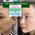 中药专业祛斑祛痘修护去痘印痘坑 图片 36