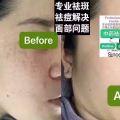 Facial中药专业祛斑痘去黄修护色素管理解决各问题性肌肤HP:81981606 图片 1