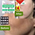 Facial中药专业祛斑痘去黄修护色素管理解决各问题性肌肤HP:81981606 图片 30