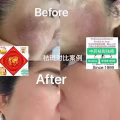 Facial中药专业祛斑痘去黄修护色素管理解决各问题性肌肤HP:81981606 图片 27