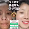 Facial中药专业祛斑痘去黄修护色素管理解决各问题性肌肤HP:81981606 图片 23