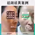 Facial中药专业祛斑痘去黄修护色素管理解决各问题性肌肤HP:81981606 图片 20