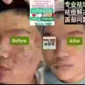 Facial中药专业祛斑痘去黄修护色素管理解决各问题性肌肤HP:81981606 图片 19