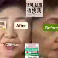Facial中药专业祛斑痘去黄修护色素管理解决各问题性肌肤HP:81981606 图片 16