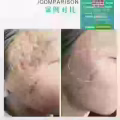Facial中药专业祛斑痘去黄修护色素管理解决各问题性肌肤HP:81981606 图片 13