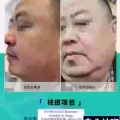 中药专业祛斑祛痘修护去痘印痘坑 图片 11