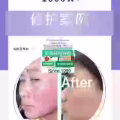 中药专业祛斑祛痘修护去痘印痘坑 图片 15