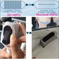 4D HIFU 超声刀 图片 10