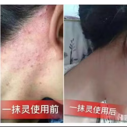 Yi Mo Ling Cream