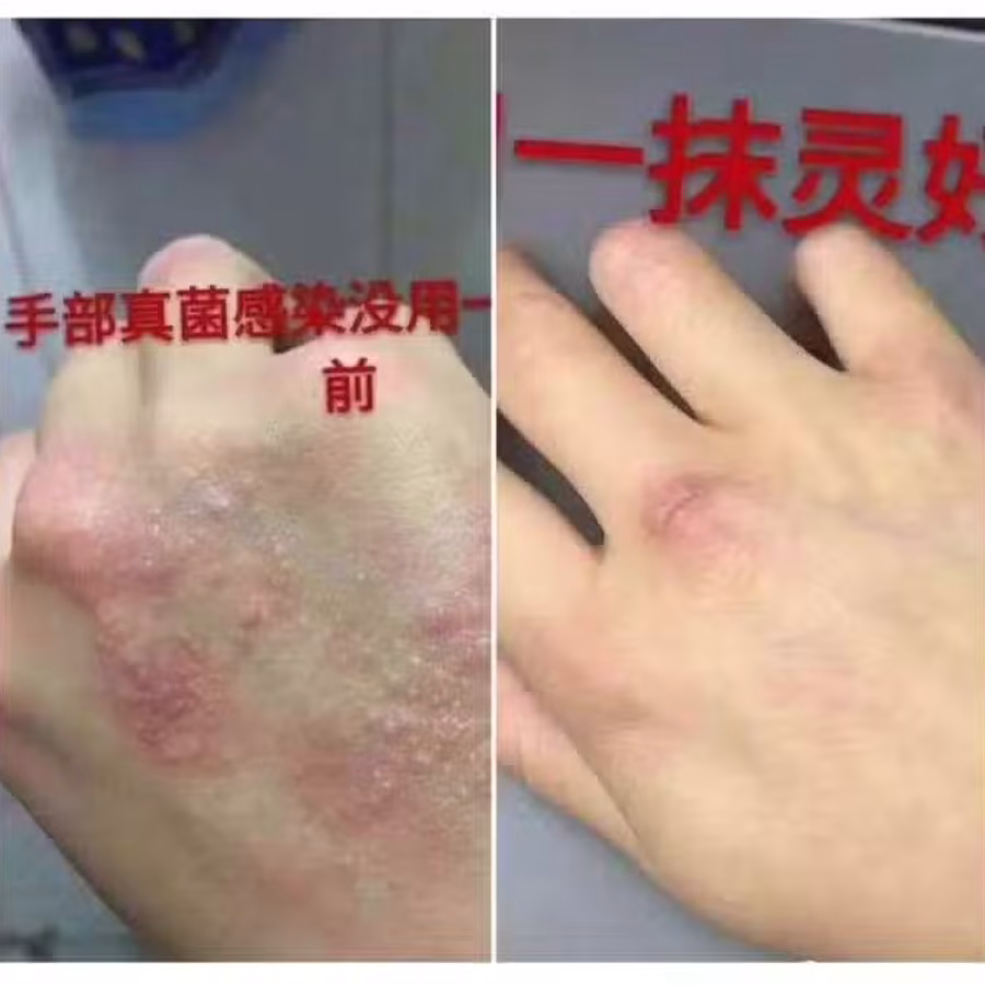Yi Mo Ling Cream 图片 2