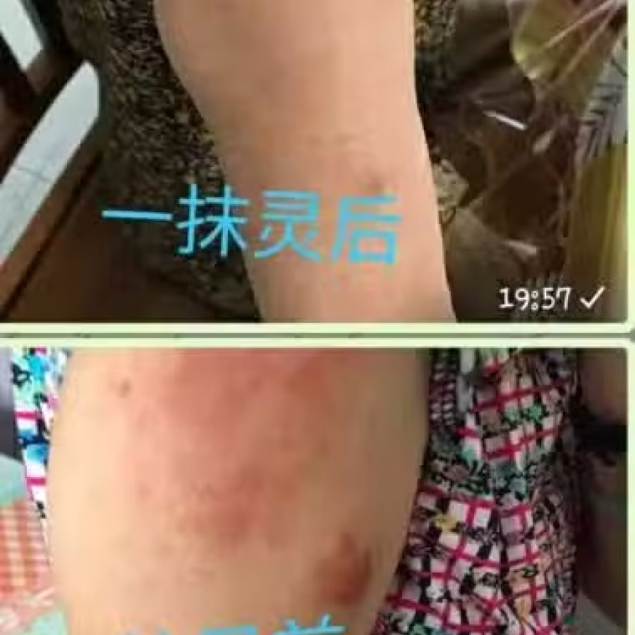 Yi Mo Ling Cream 图片 4