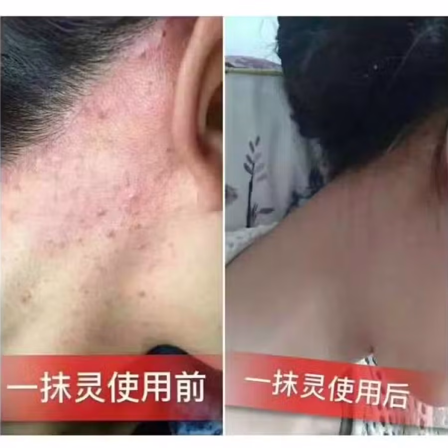 Yi Mo Ling Cream 图片 5