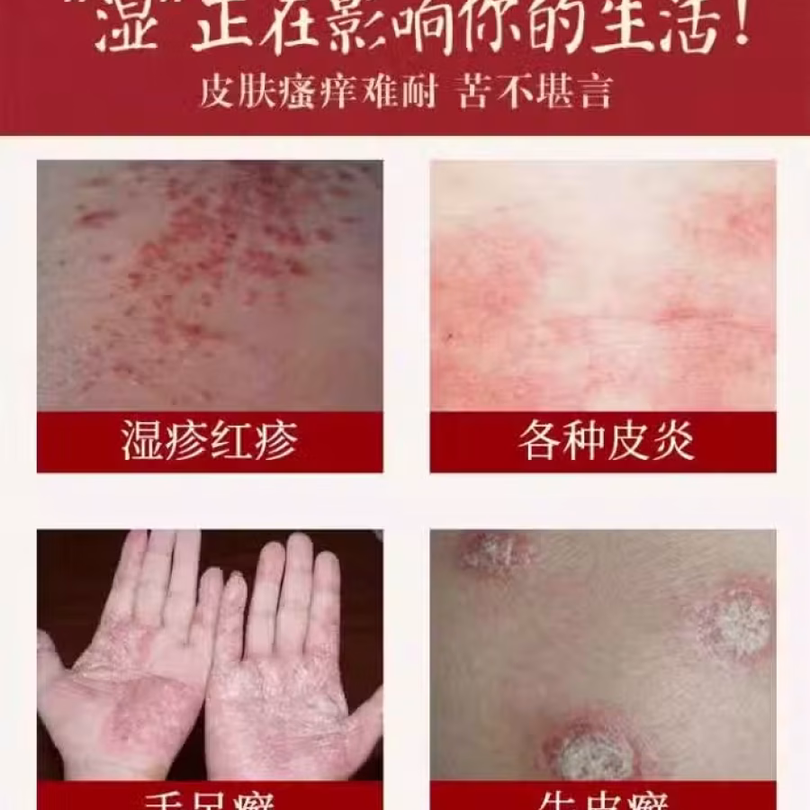 一抹灵/祛“湿”好货（现货）不含激素 图片 2