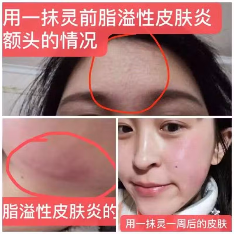 一抹灵/祛“湿”好货（现货）不含激素 图片 4