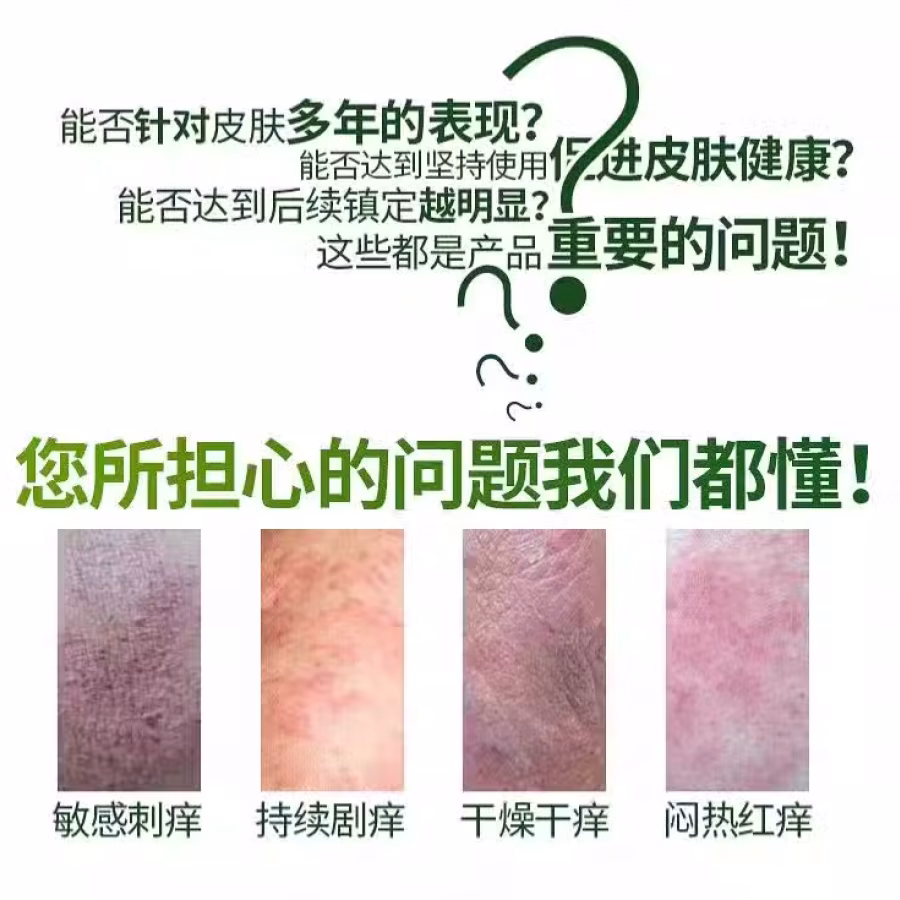土方皮癣膏牛皮癣药膏土方脚气药膏湿疹寻麻疹皮炎过敏毛囊炎止痒脚气脱皮糜烂脚臭酸臭 图片 22