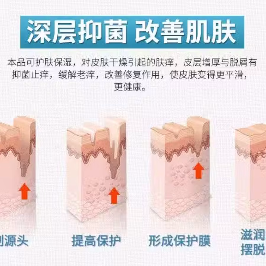 土方皮癣膏牛皮癣药膏土方脚气药膏湿疹寻麻疹皮炎过敏毛囊炎止痒脚气脱皮糜烂脚臭酸臭 图片 23