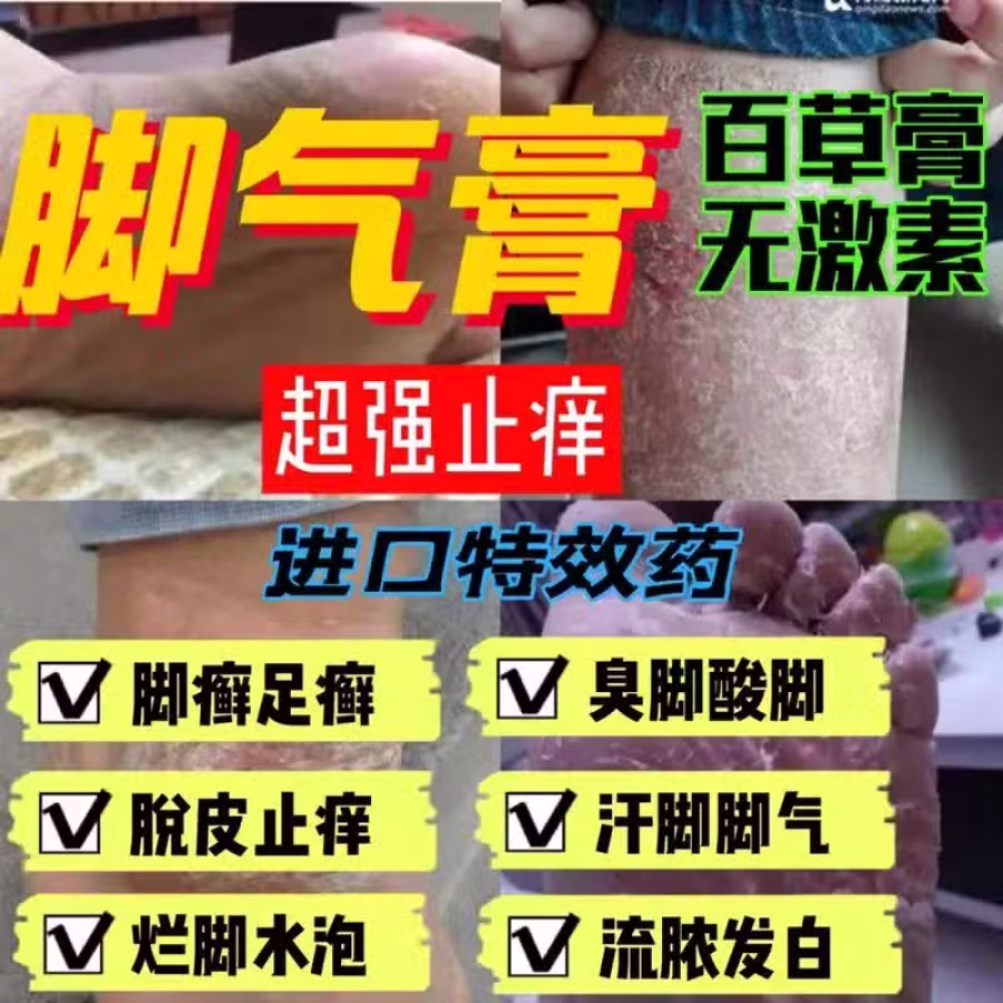 土方皮癣膏牛皮癣药膏土方脚气药膏湿疹寻麻疹皮炎过敏毛囊炎止痒脚气脱皮糜烂脚臭酸臭 图片 20