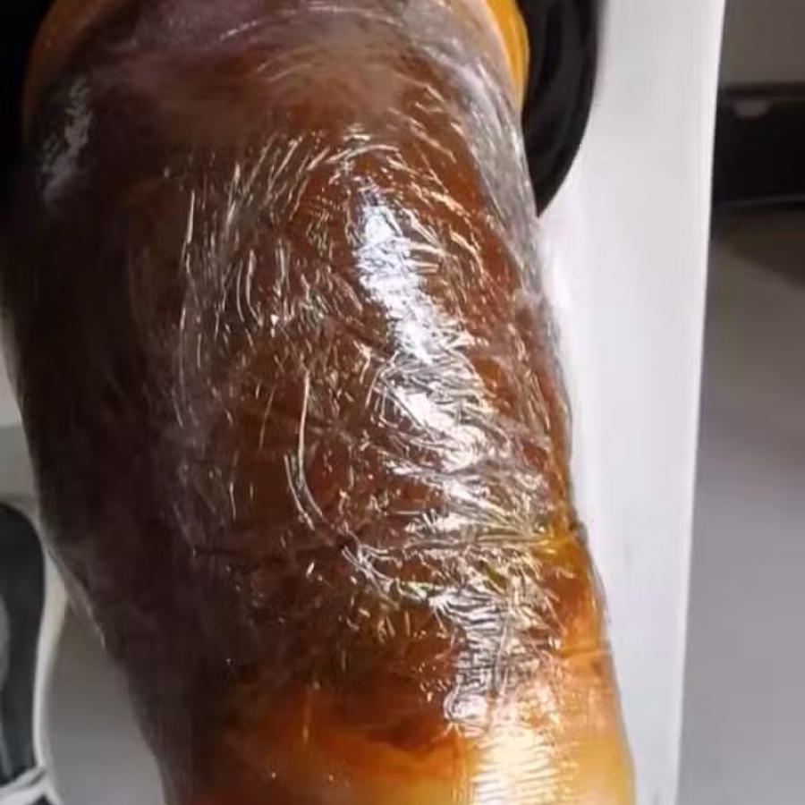 治疗湿疹风湿关节炎的产品 图片 2