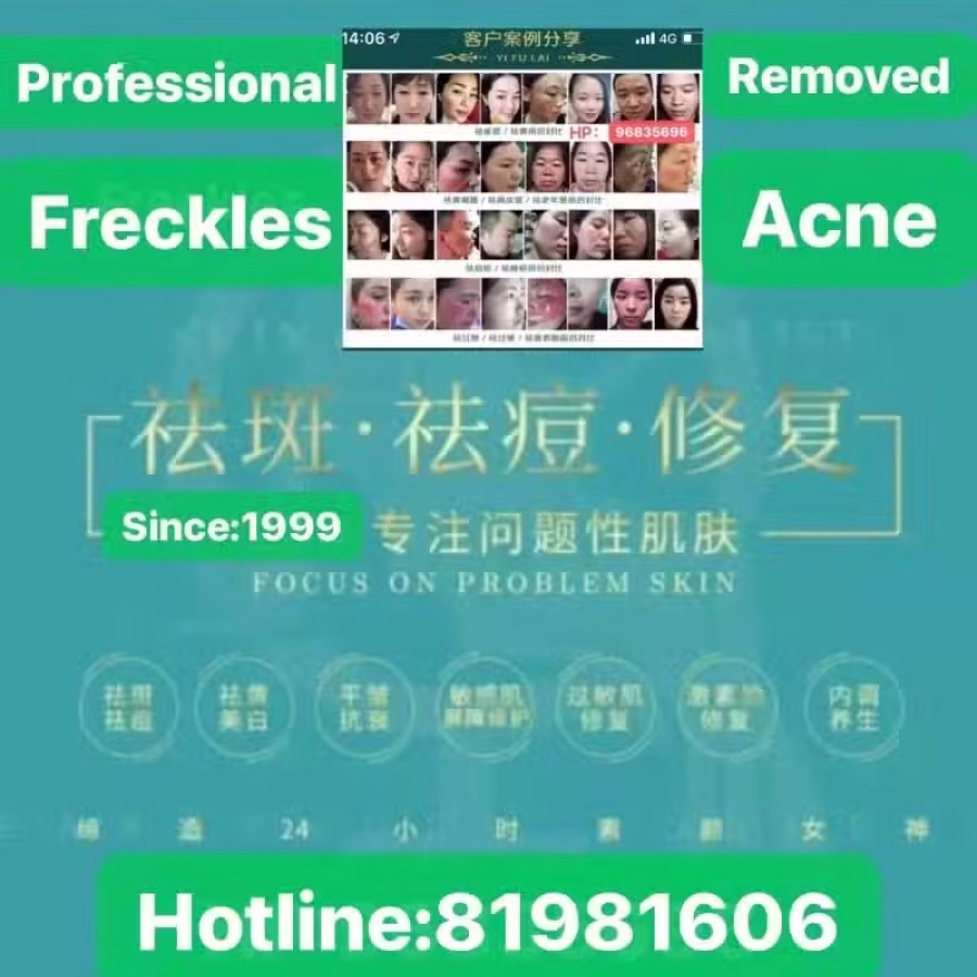 中药专业祛斑祛痘修护去痘印痘坑 图片 32
