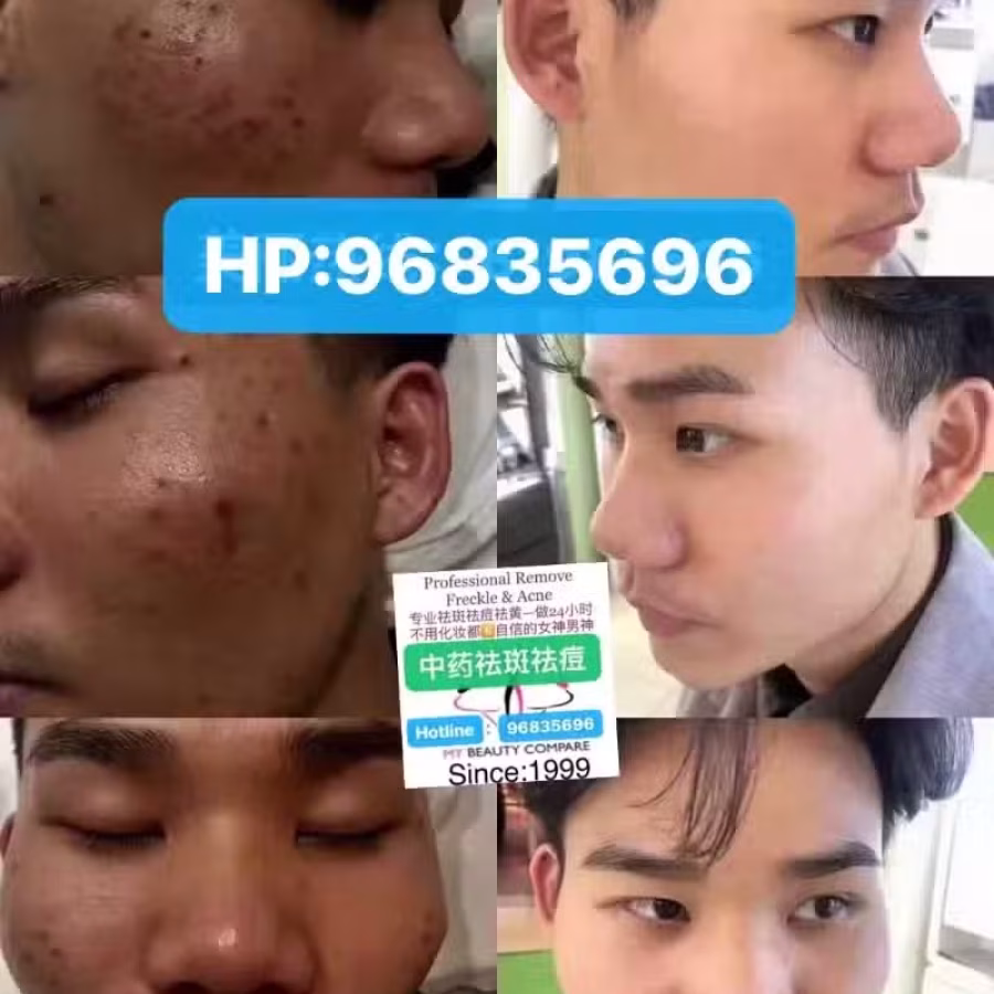 中药专业祛斑祛痘修护去痘印痘坑 图片 13