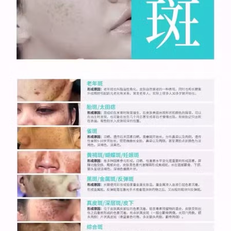 中药专业祛斑祛痘修护去痘印痘坑 图片 47