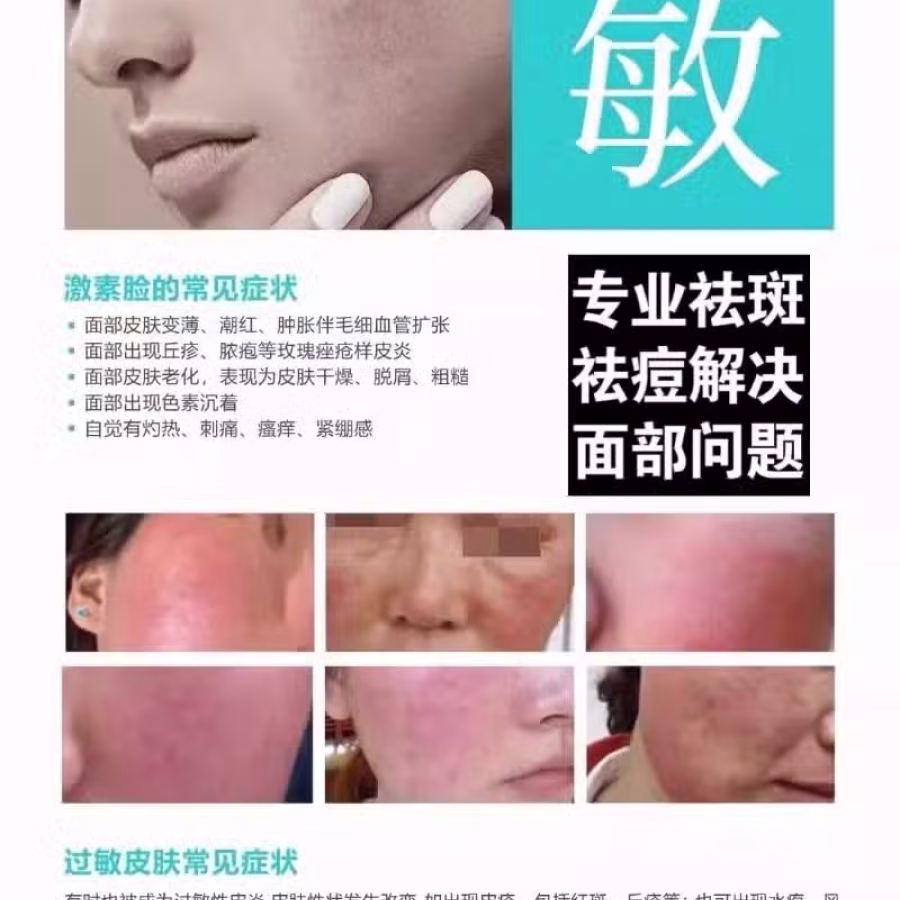 中药专业祛斑祛痘修护去痘印痘坑 图片 38