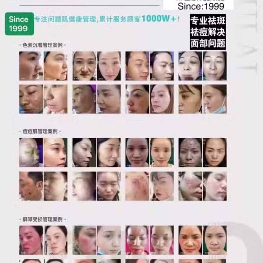 中药专业祛斑祛痘修护去痘印痘坑 图片 35