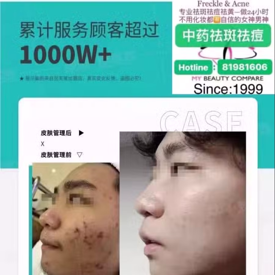 中药专业祛斑祛痘修护去痘印痘坑 图片 44
