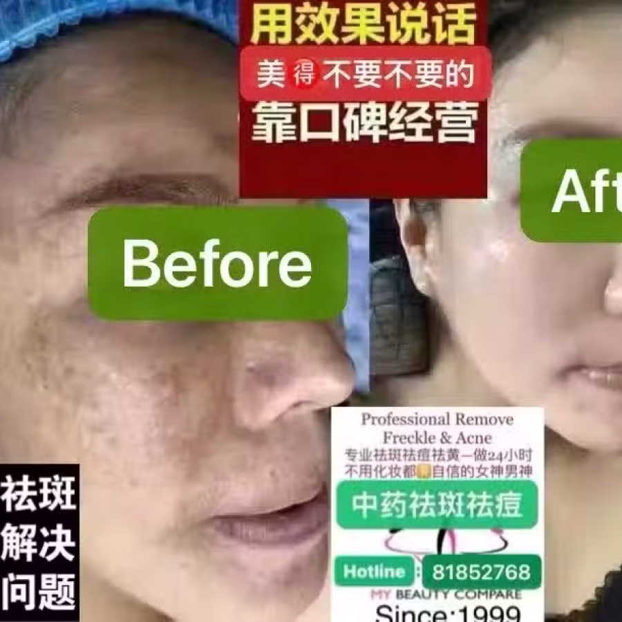 Facial中药专业祛斑痘去黄修护色素管理解决各问题性肌肤HP:81981606 图片 8