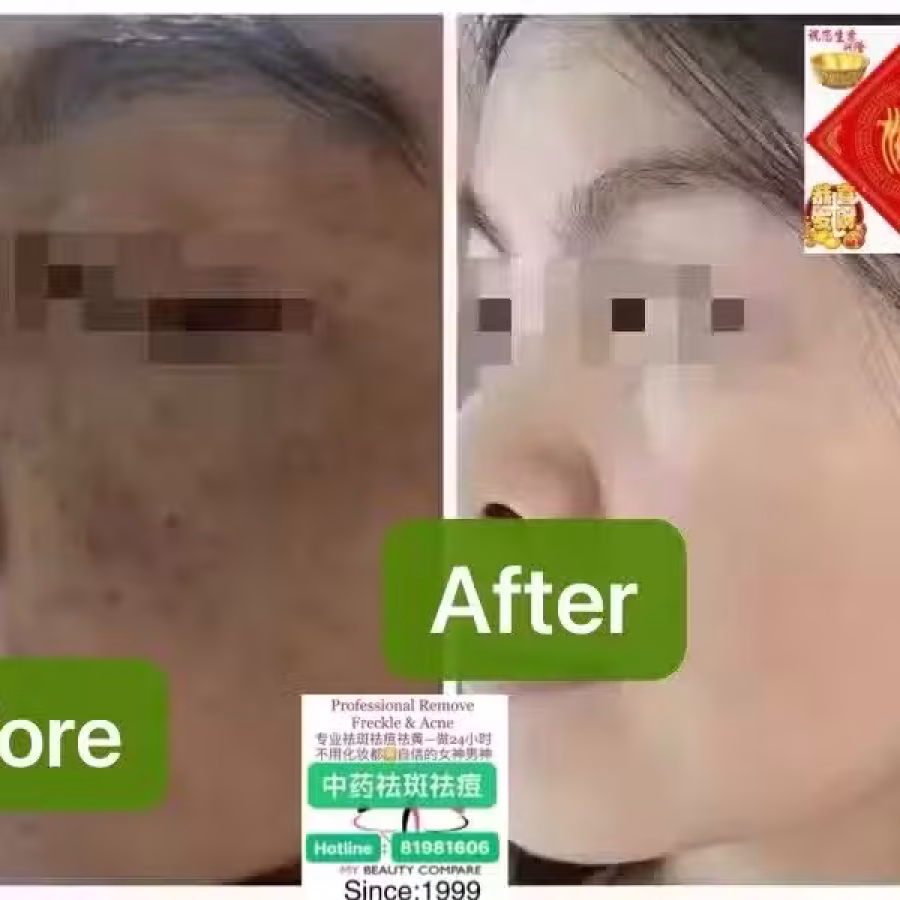 Facial中药专业祛斑痘去黄修护色素管理解决各问题性肌肤HP:81981606 图片 29