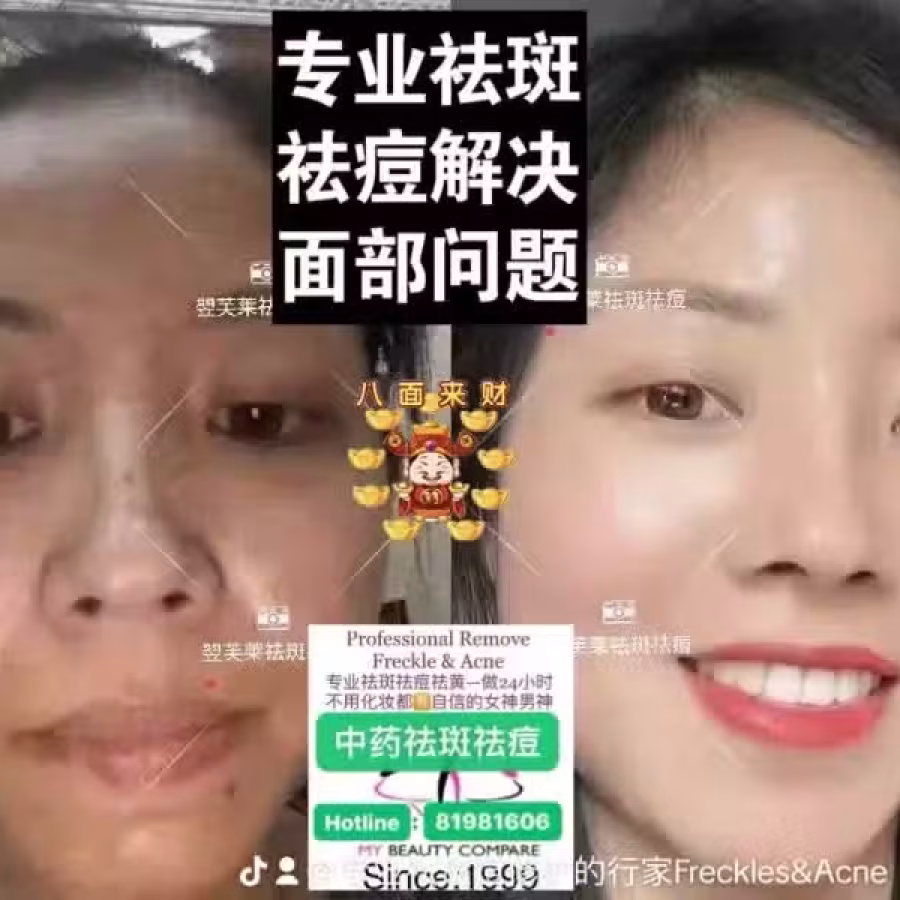 Facial中药专业祛斑痘去黄修护色素管理解决各问题性肌肤HP:81981606 图片 23
