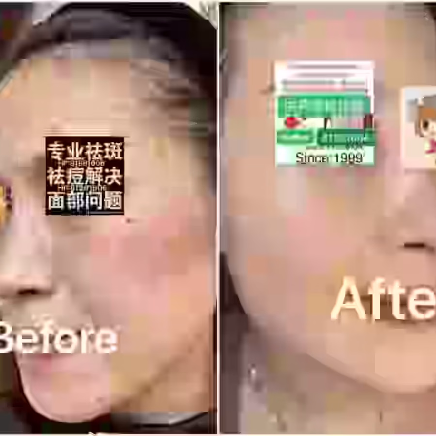 Facial中药专业祛斑痘去黄修护色素管理解决各问题性肌肤HP:81981606 图片 21