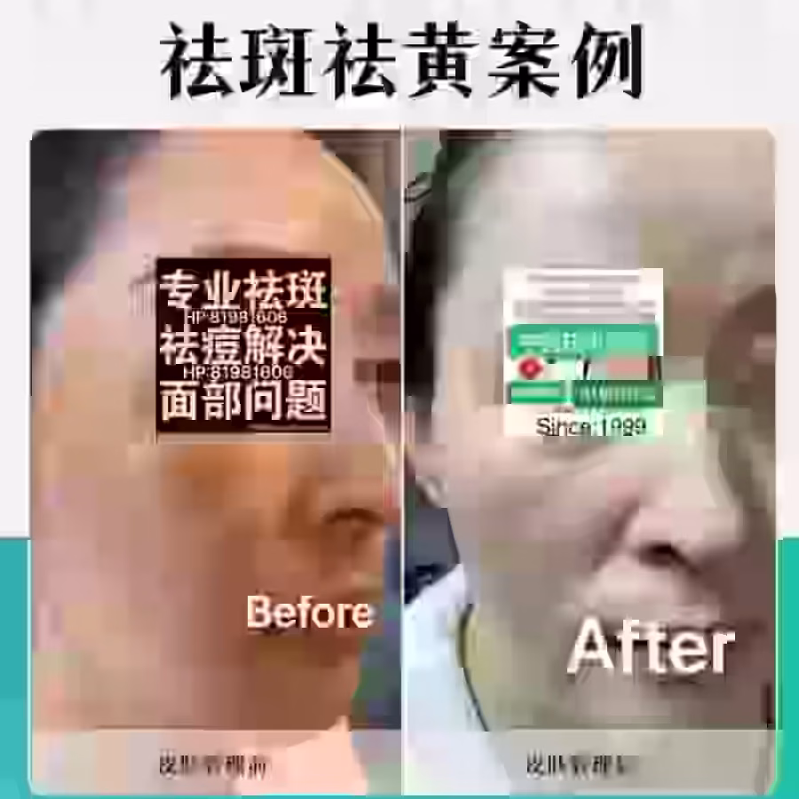 Facial中药专业祛斑痘去黄修护色素管理解决各问题性肌肤HP:81981606 图片 20
