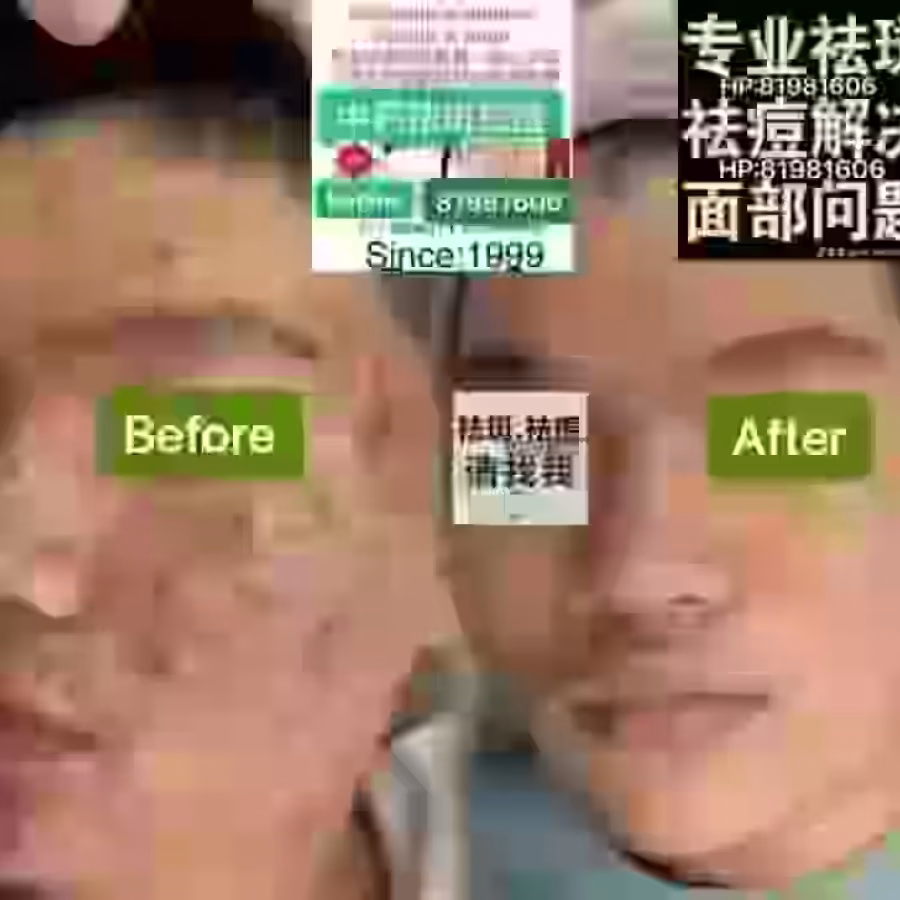 Facial中药专业祛斑痘去黄修护色素管理解决各问题性肌肤HP:81981606 图片 19