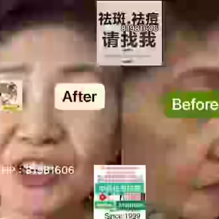 Facial中药专业祛斑痘去黄修护色素管理解决各问题性肌肤HP:81981606 图片 16
