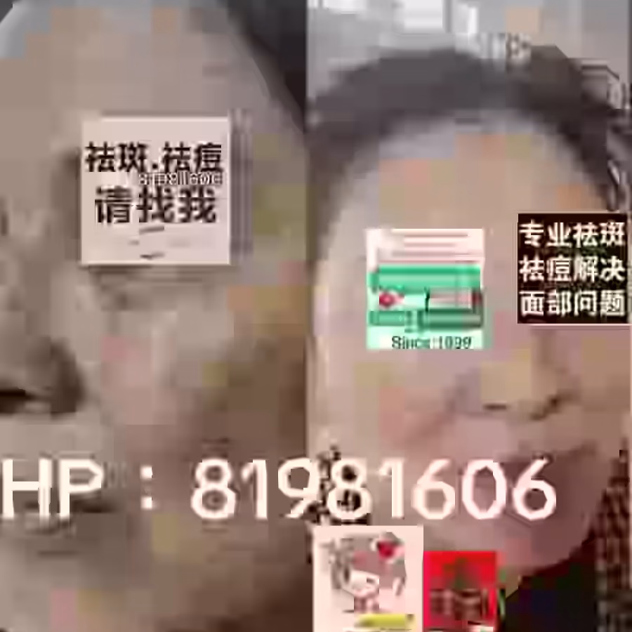 Facial中药专业祛斑痘去黄修护色素管理解决各问题性肌肤HP:81981606 图片 15