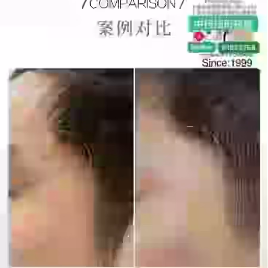 Facial中药专业祛斑痘去黄修护色素管理解决各问题性肌肤HP:81981606 图片 14