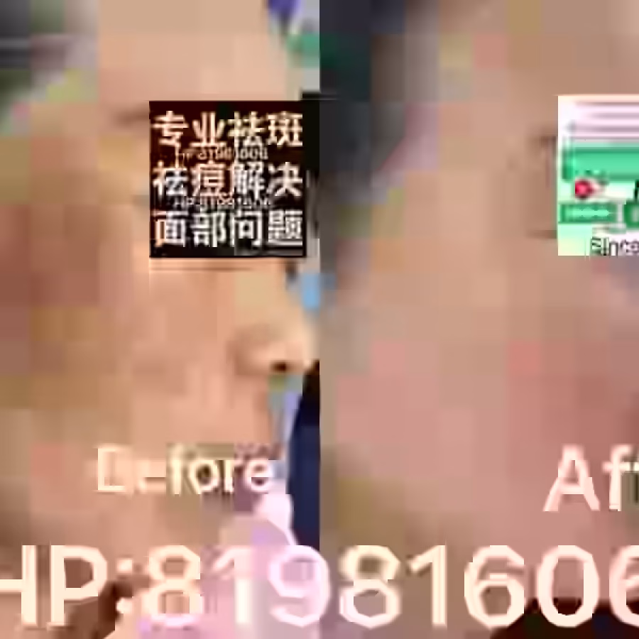 中药专业祛斑祛痘修护去痘印痘坑 图片 24