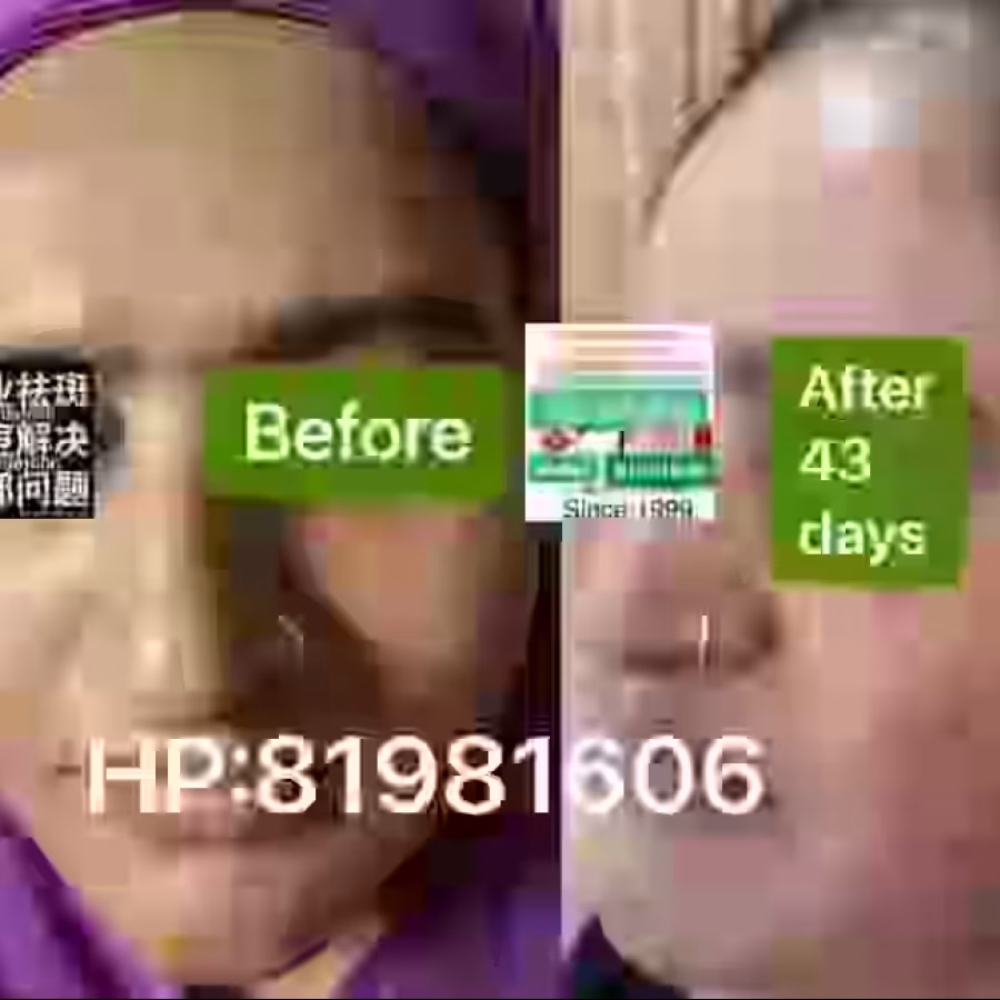 中药专业祛斑祛痘修护去痘印痘坑 图片 2