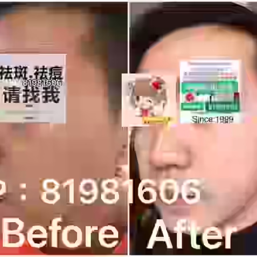 中药专业祛斑祛痘修护去痘印痘坑 图片 12