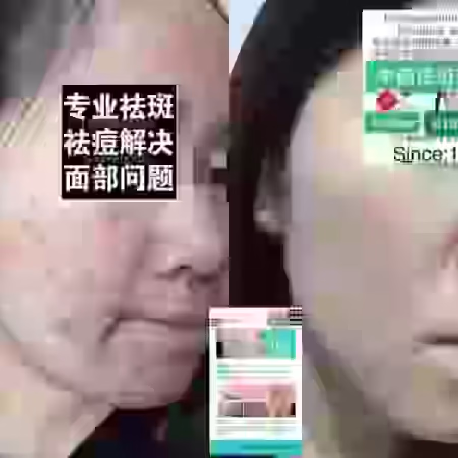 中药专业祛斑祛痘修护去痘印痘坑 图片 14