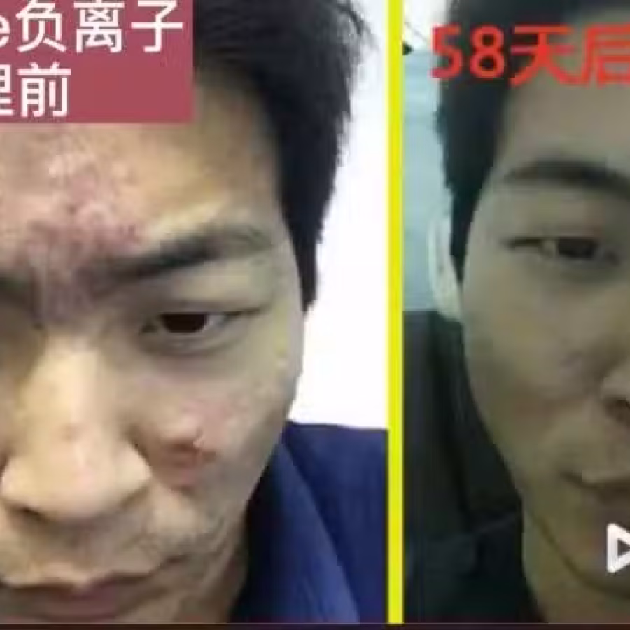 NewLife高浓度负氧离子仪（全岛招商） 图片 21