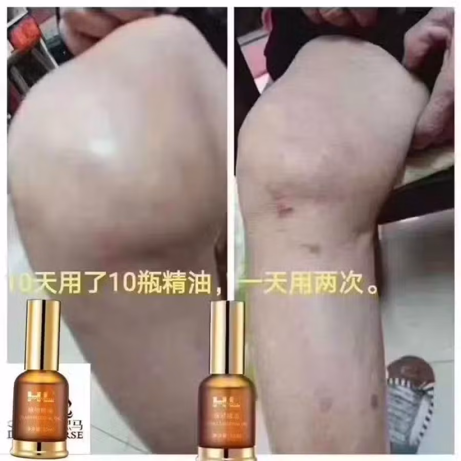 植物精油 图片 3